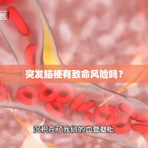 突發(fā)腦梗有致命風(fēng)險嗎？