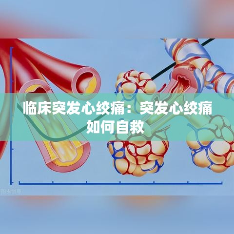 臨床突發(fā)心絞痛：突發(fā)心絞痛如何自救 