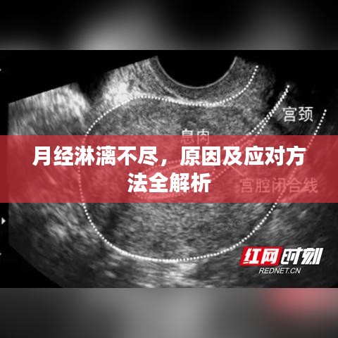 月經(jīng)淋漓不盡，原因及應(yīng)對(duì)方法全解析