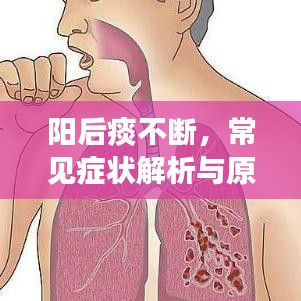 陽后痰不斷，常見癥狀解析與原因探究